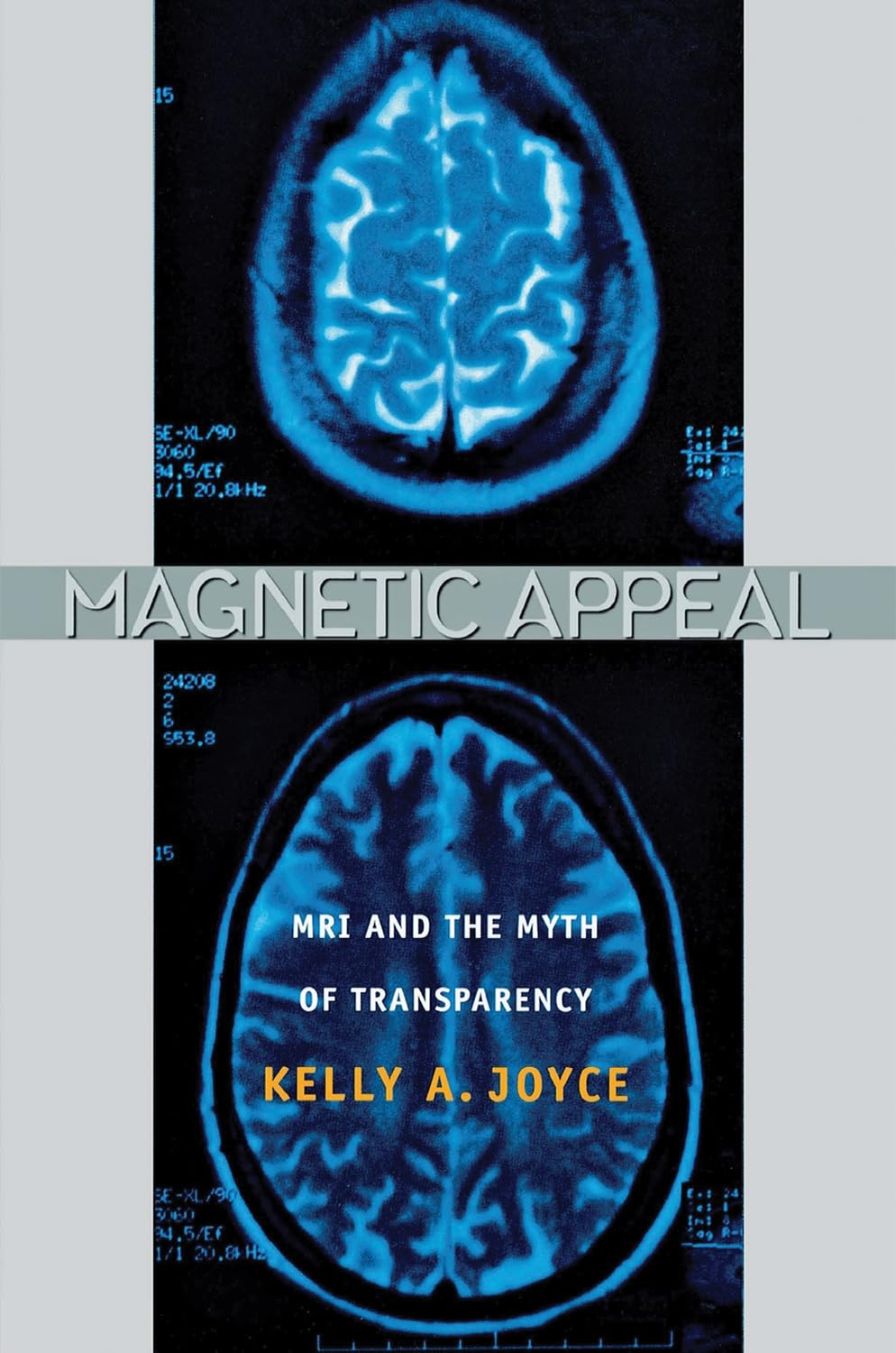 Magnetic Appeal: MRI and the Myth of Transparency Medicine