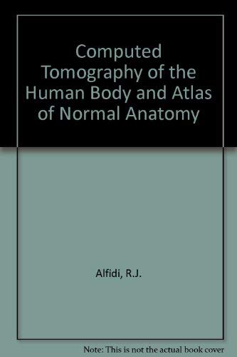 Computerized Tomography of the Human Body: An Atlas of Normal Anatomy Medicine