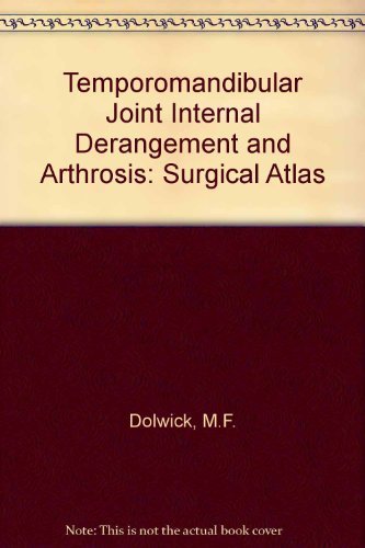 Tmj Internal Derangement & Arthrosis: Surgical Atlas Medicine