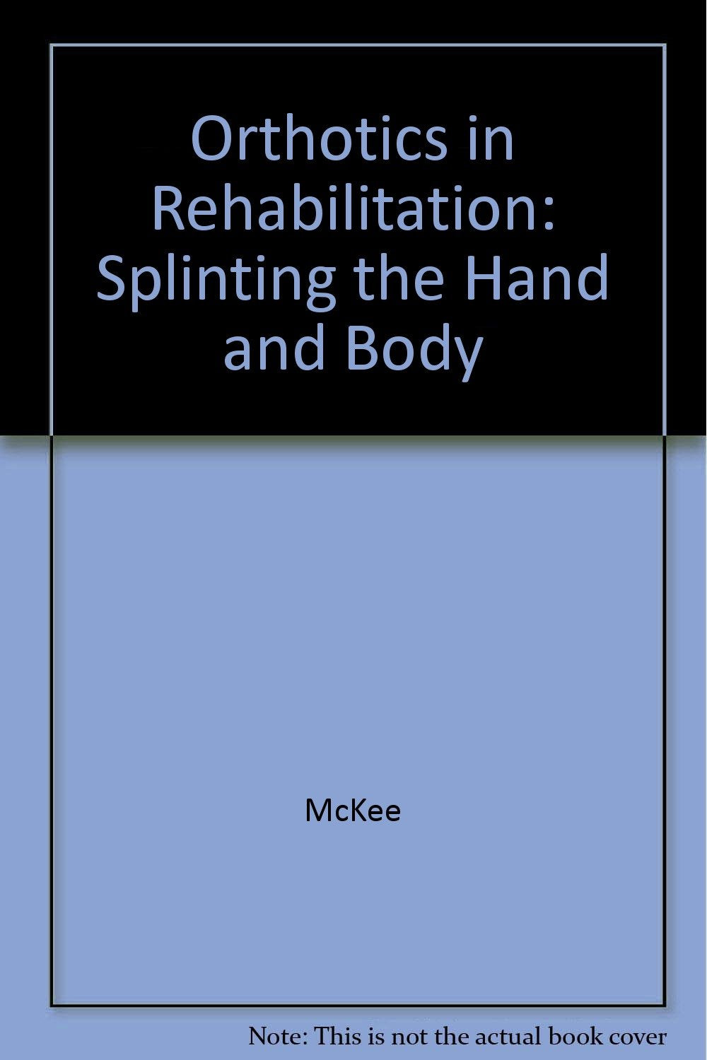 Orthotics In Rehabilitation: Splinting The Hand And Body Medicine