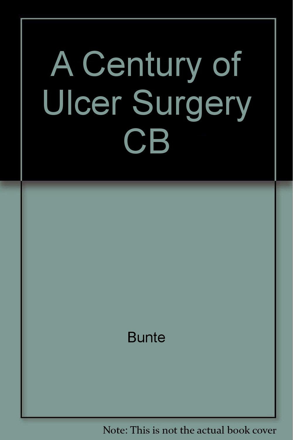 A Century of Ulcer Surgery CB Medicine