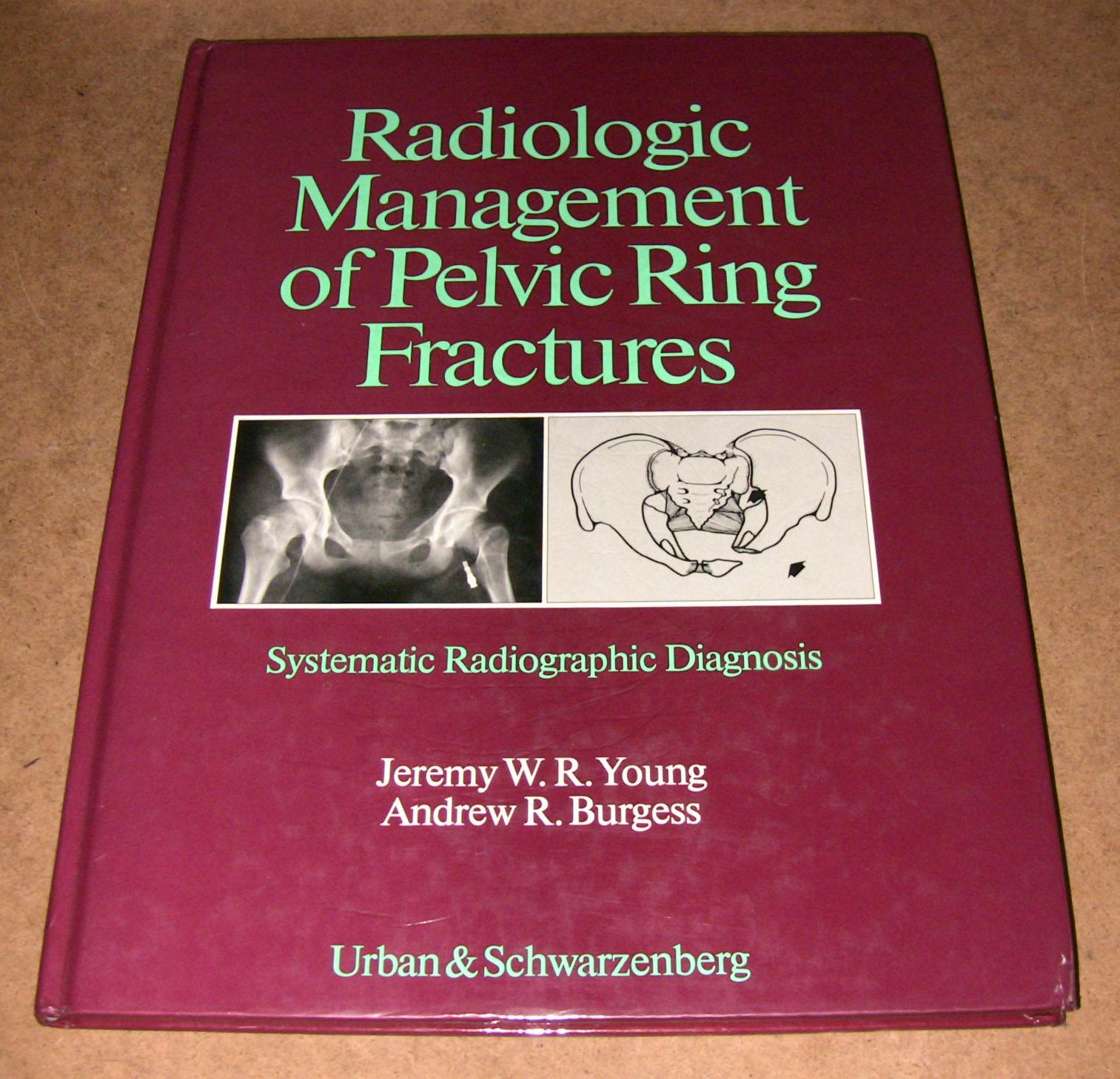 Radiologic Management of Pelvic Ring Fractures: Systematic Radiographic Diagnosis Medicine