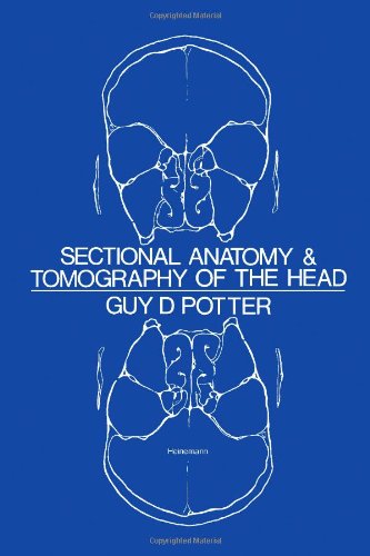 Sectional anatomy and tomography of the head Books