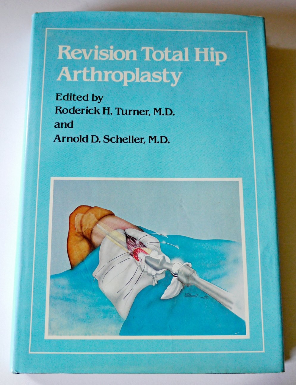 Product Image: Revision Total Hip Arthroplasty