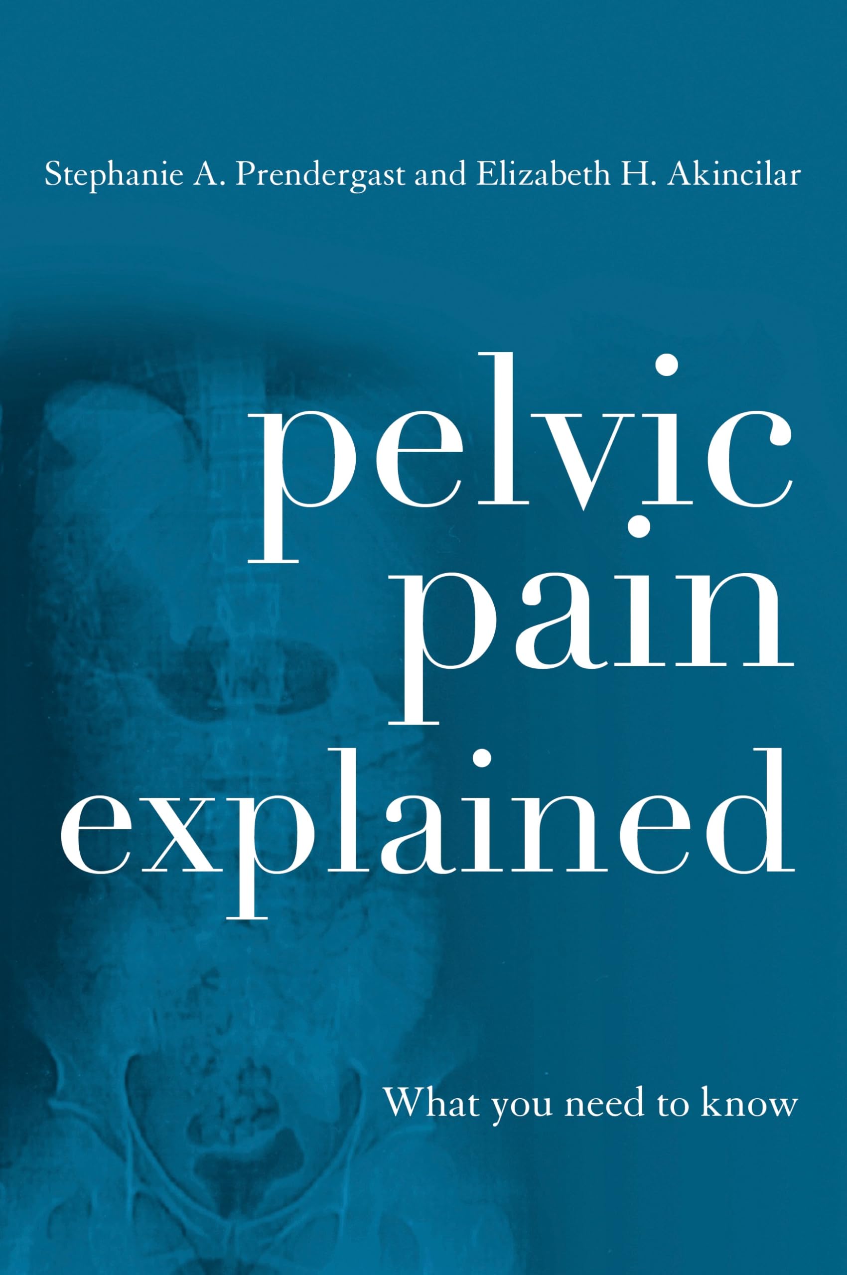 Pelvic Pain Explained: What You Need to Know Medicine