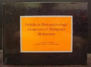 Pitfalls in Histopathologic Diagnosis of Malignant Melanoma Medicine