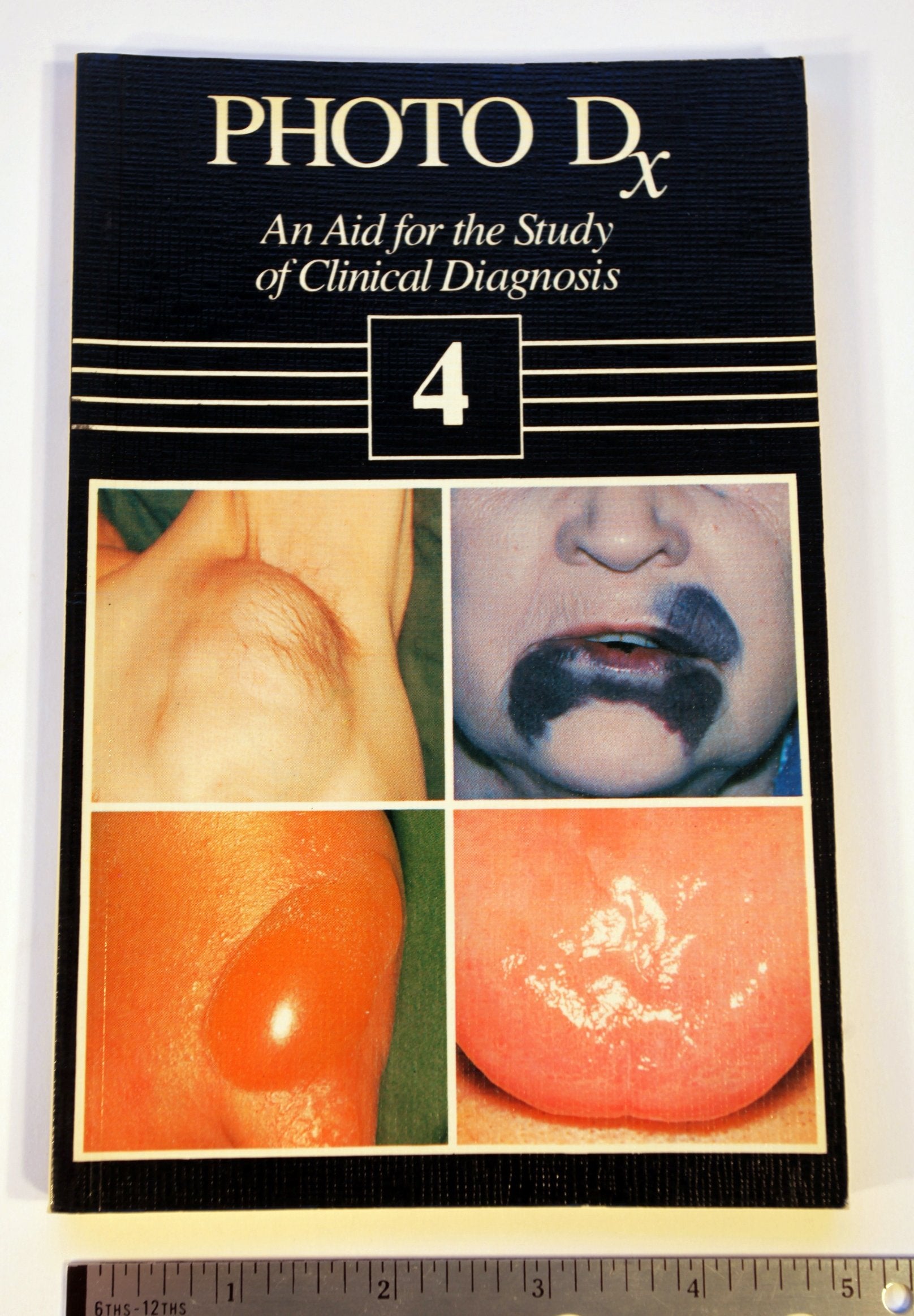 Photo Dx: An Aid for the Study of Clinical Diagnosis Medicine