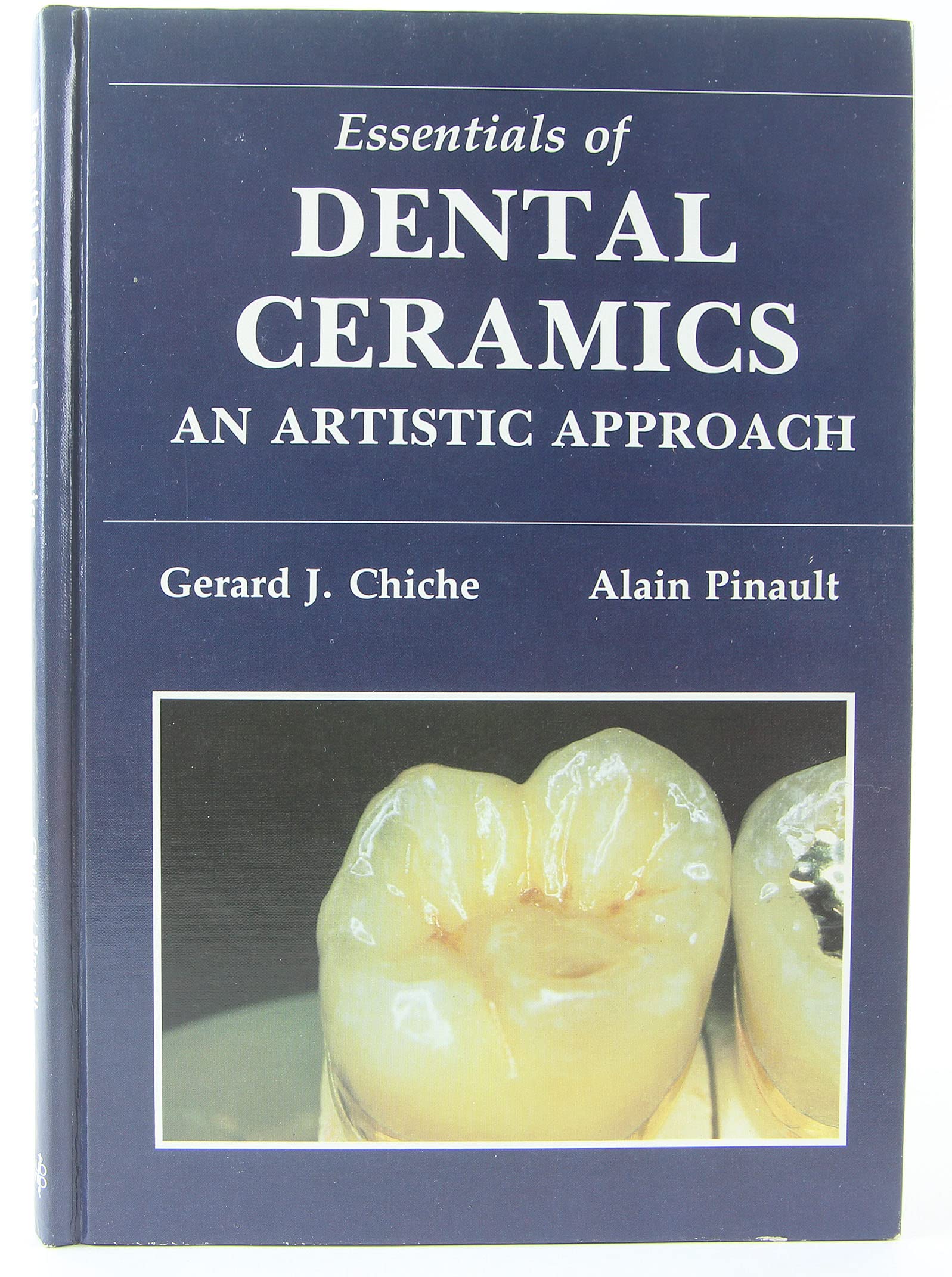 Essentials of Dental Ceramics: An Artistic Approach Medicine