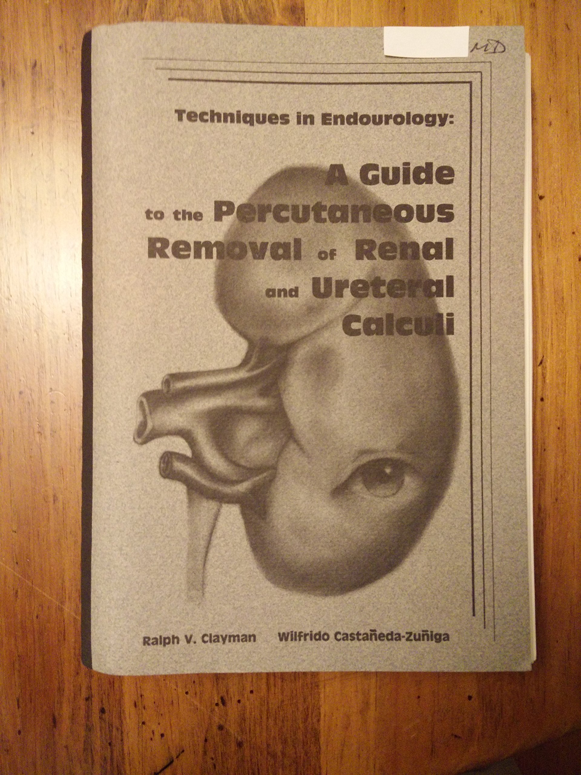 Techniques in endourology: A guide to the percutaneous removal of renal and u... Books