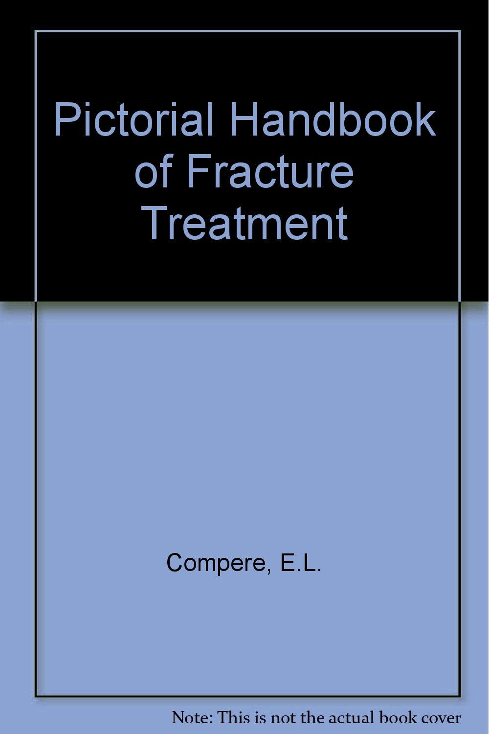 Pictorial Handbook of Fracture Treatment Books