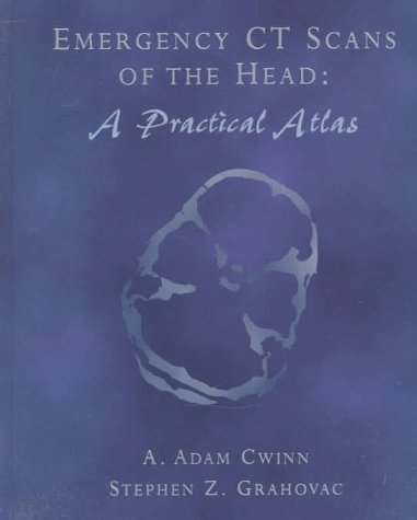 Emergency Ct Scans of the Head: A Practical Atlas Medicine