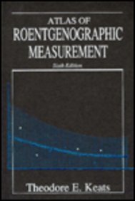 Atlas of Normal Roentgen Variants That May Simulate Disease Medicine