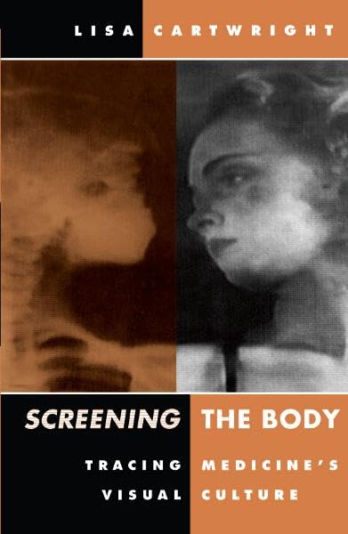 Screening The Body: Tracing Medicine's Visual Culture Medicine