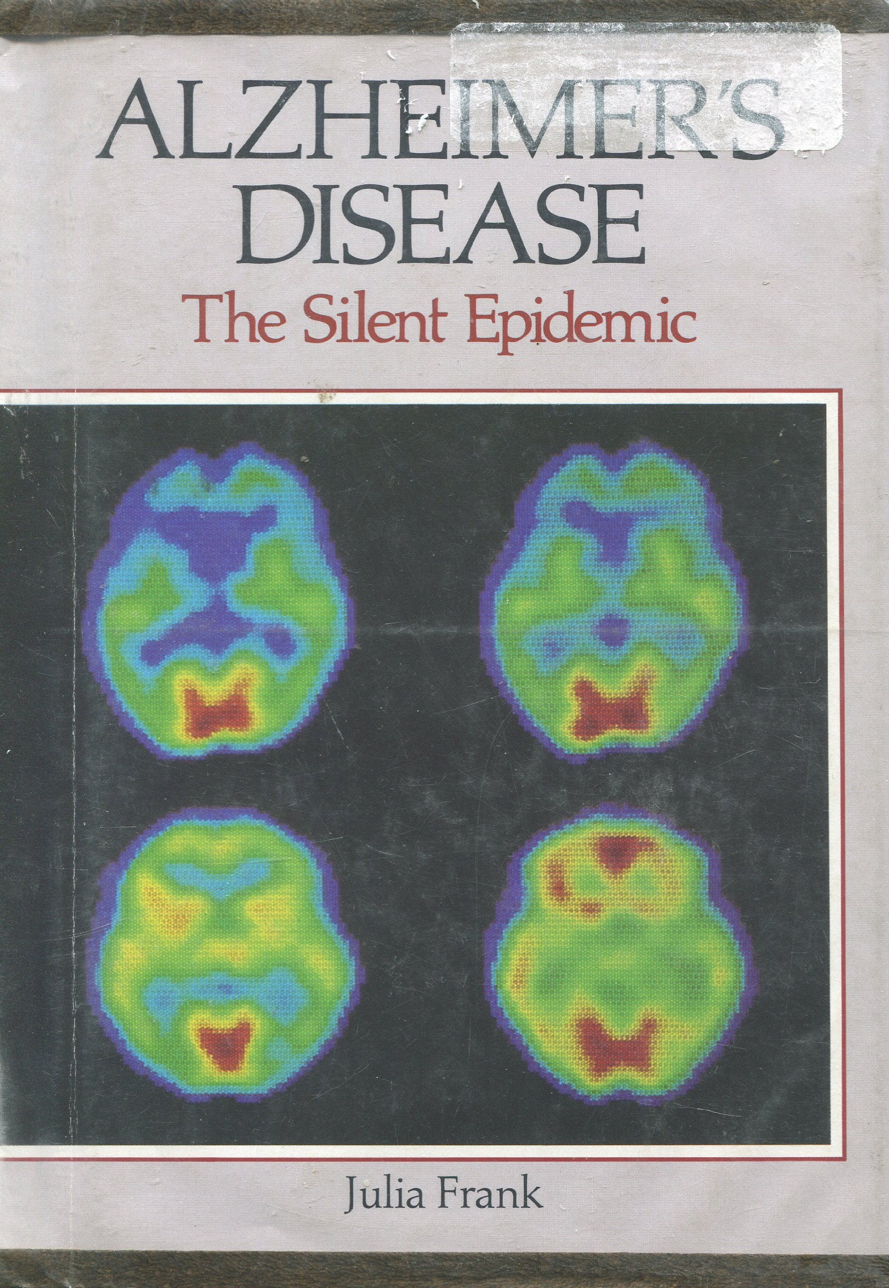 Alzheimer's Disease: The Silent Epidemic (Discovery) Young adult books