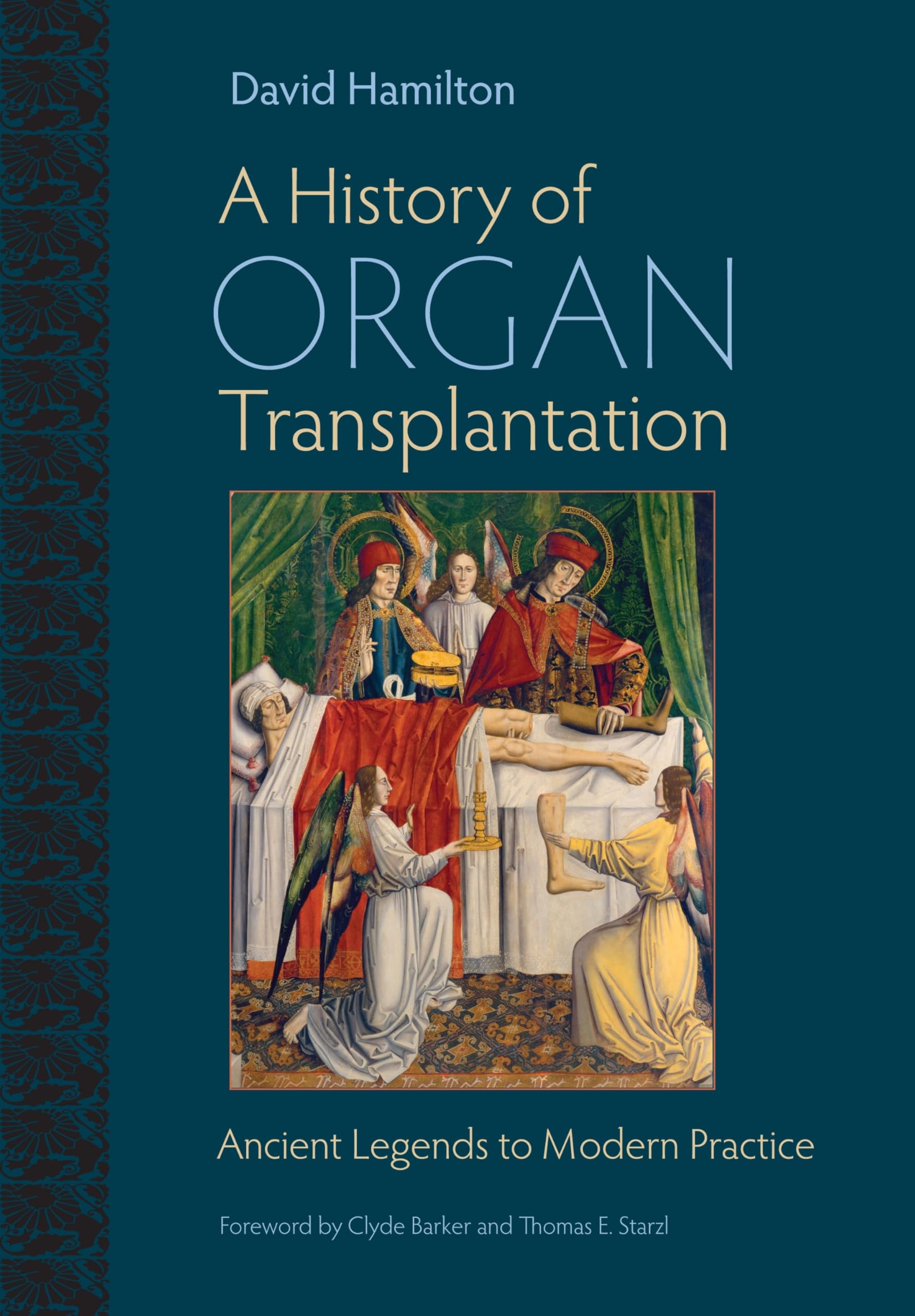 A History of Organ Transplantation: Ancient Legends to Modern Practice Medicine