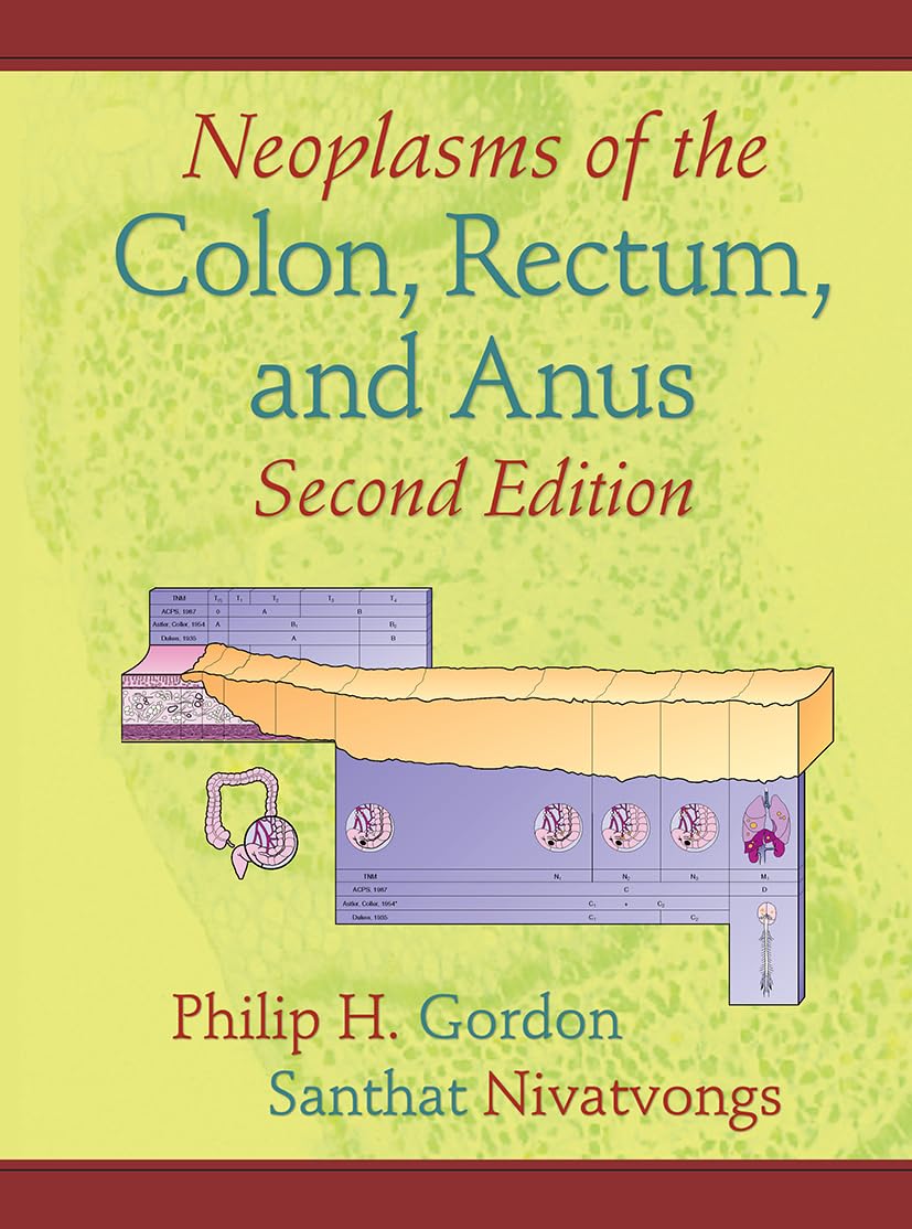 Neoplasms of the Colon, Rectum, And Anus Medicine