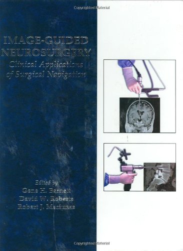 Image Guided Neurosurgery: Clinical Applications of Surgical Navigation Medicine