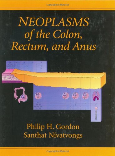 Neoplasms of the Colon, Rectum, and Anus Medicine