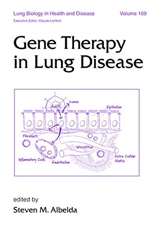Gene Therapy in Lung Disease (Lung Biology in Health and Disease) Books