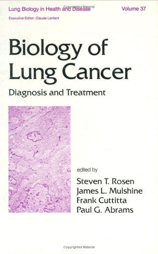Biology of Lung Cancer: Diagnosis and Treatment book