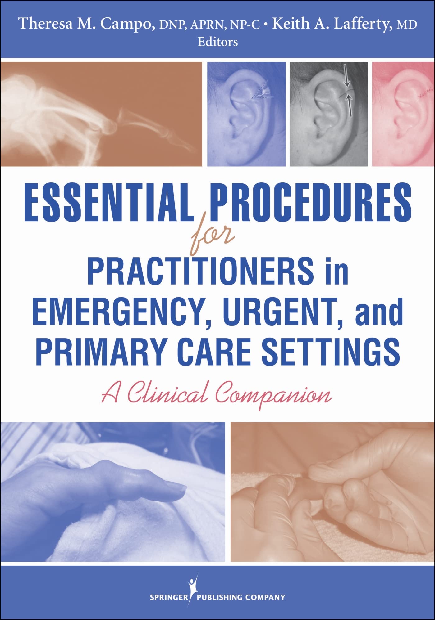 Essential Procedures for Practitioners in Emergency, Urgent, and Primary Care Settings: A Clinical Companion Medicine