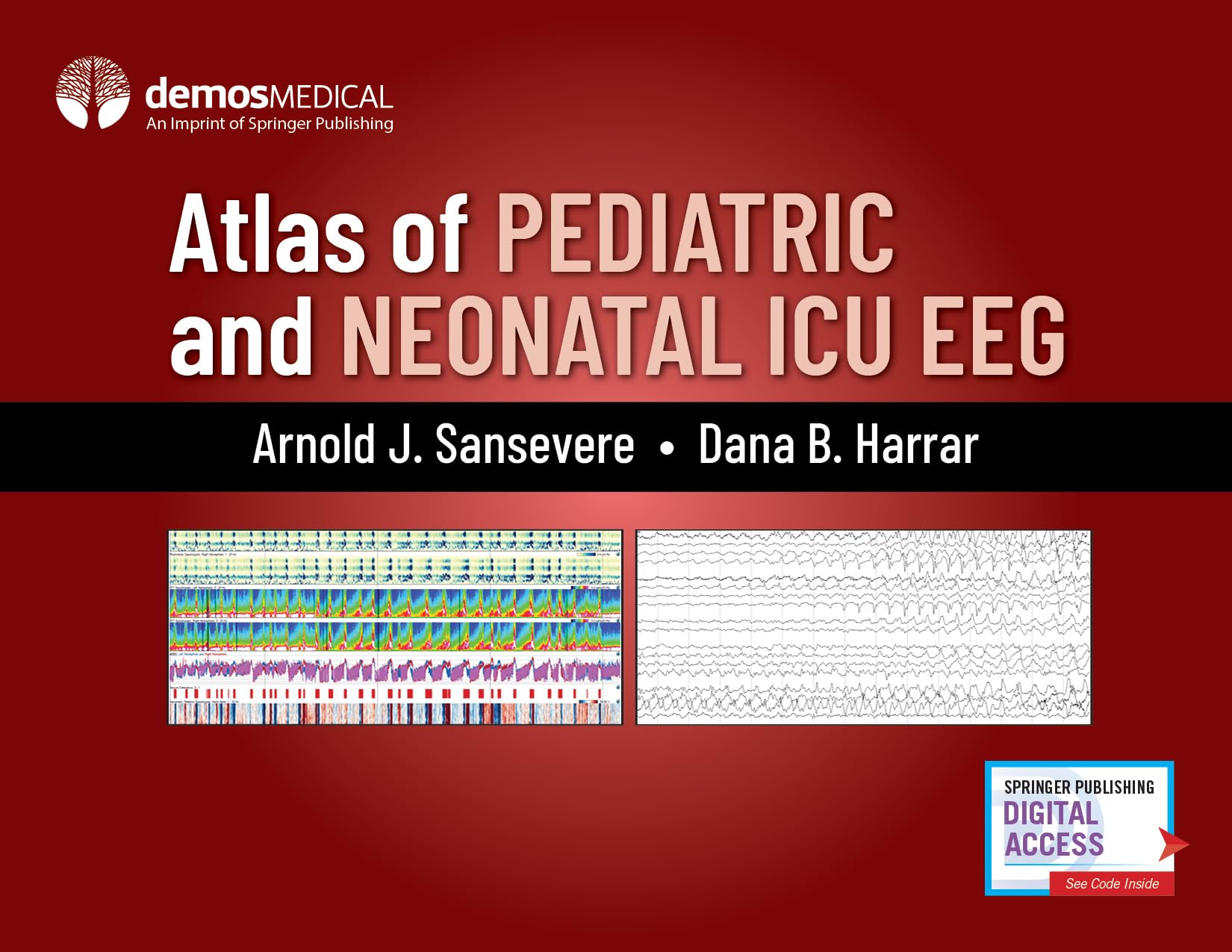 Atlas of Pediatric and Neonatal ICU EEG Medicine