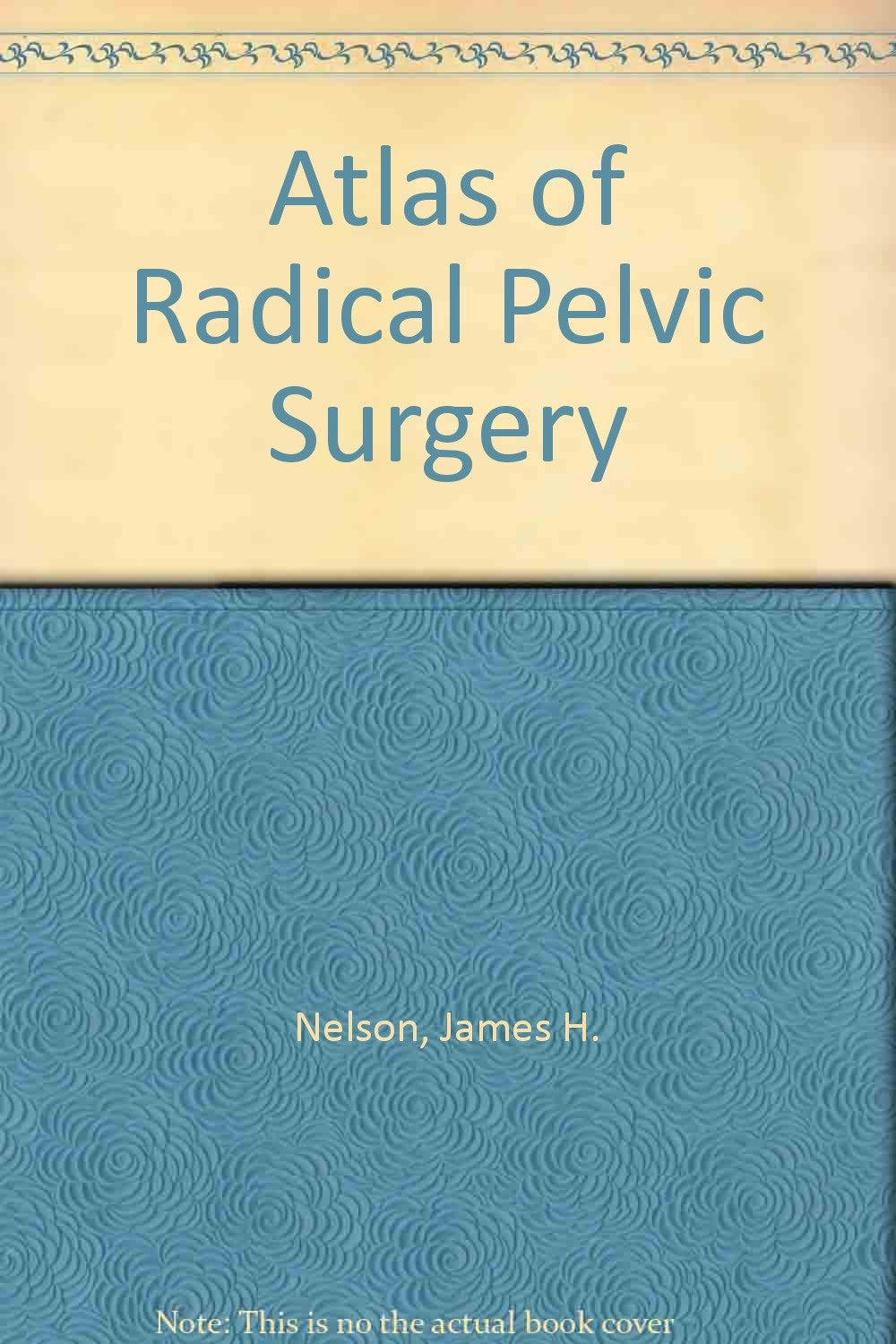 Atlas of Radical Pelvic Surgery Books