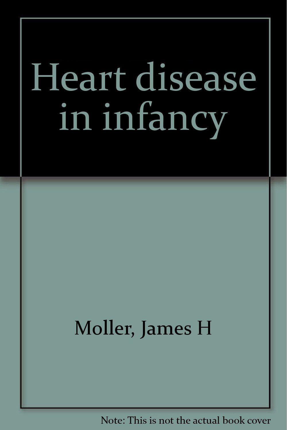 Heart disease in infancy Books