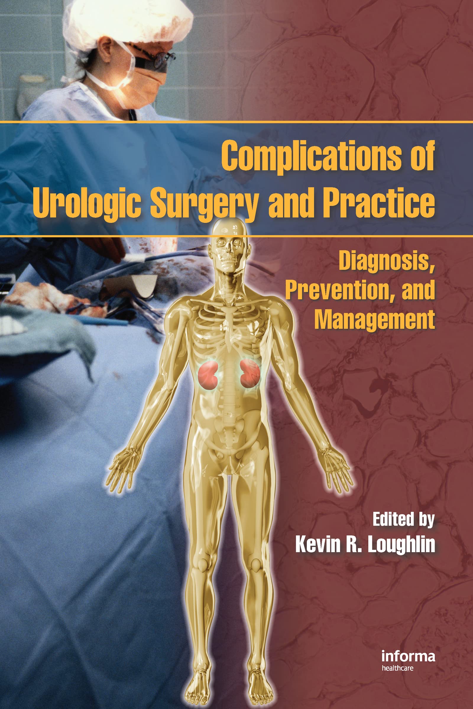 Complications of Urologic Surgery and Practice: Diagnosis, Prevention, and Management Medicine