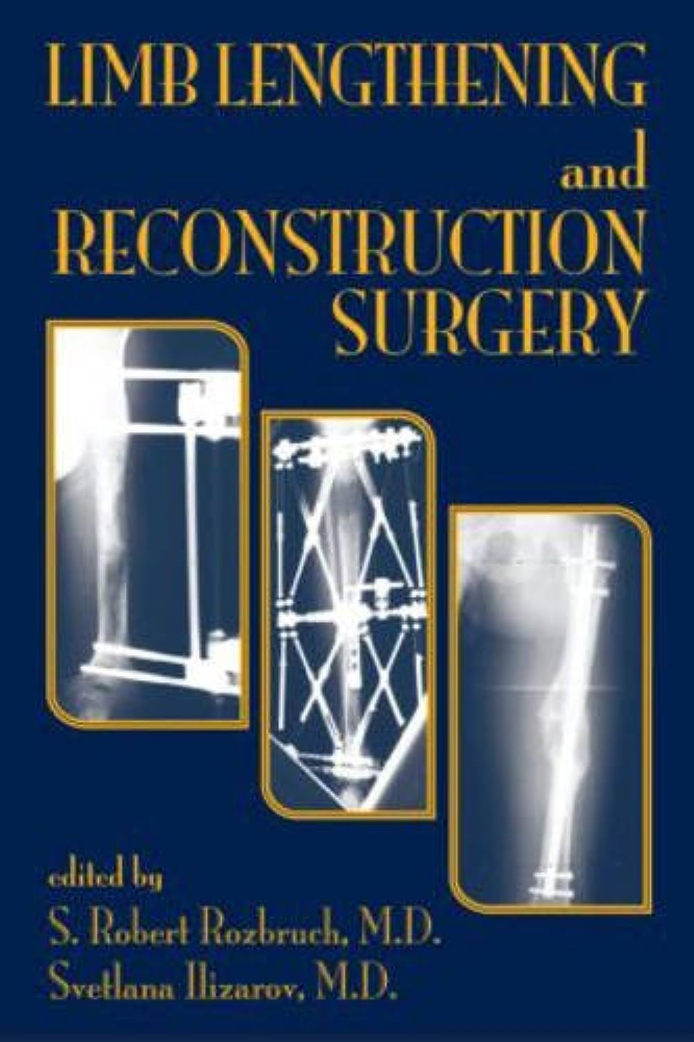 Limb Lengthening and Reconstruction Surgery Medicine