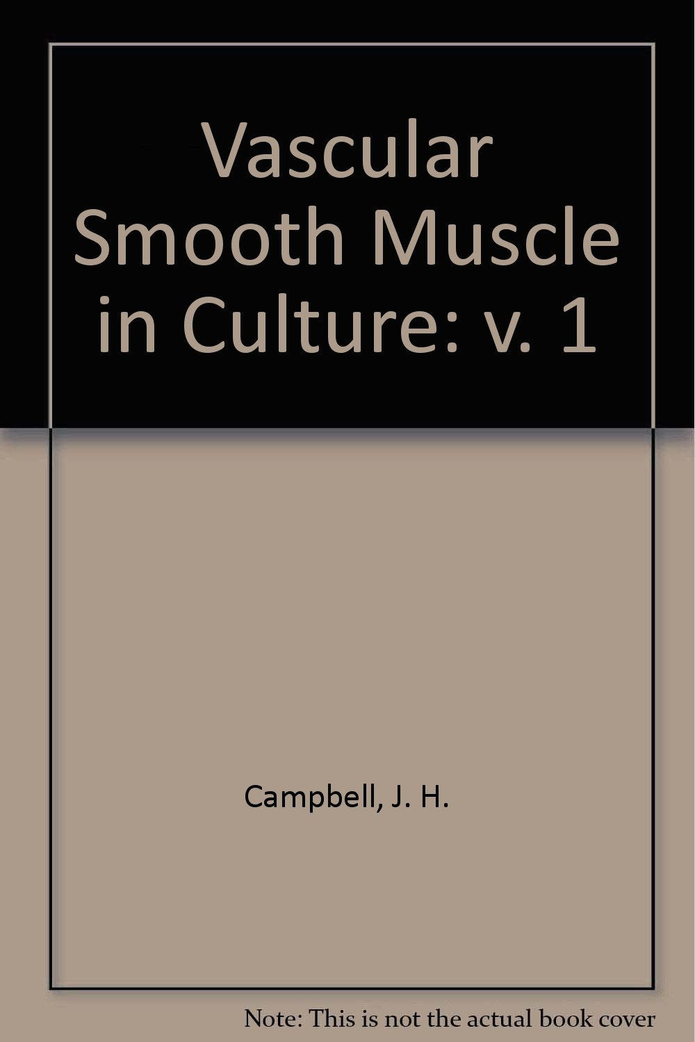 Vasular Smooth Muscle in Culture Medicine