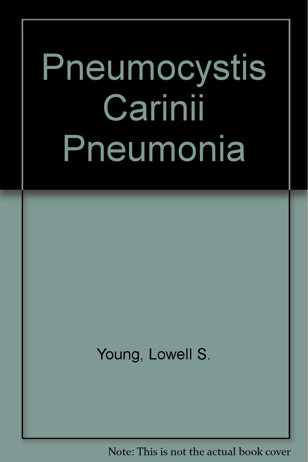 Pneumocystis Carinii Pneumonitis Medicine