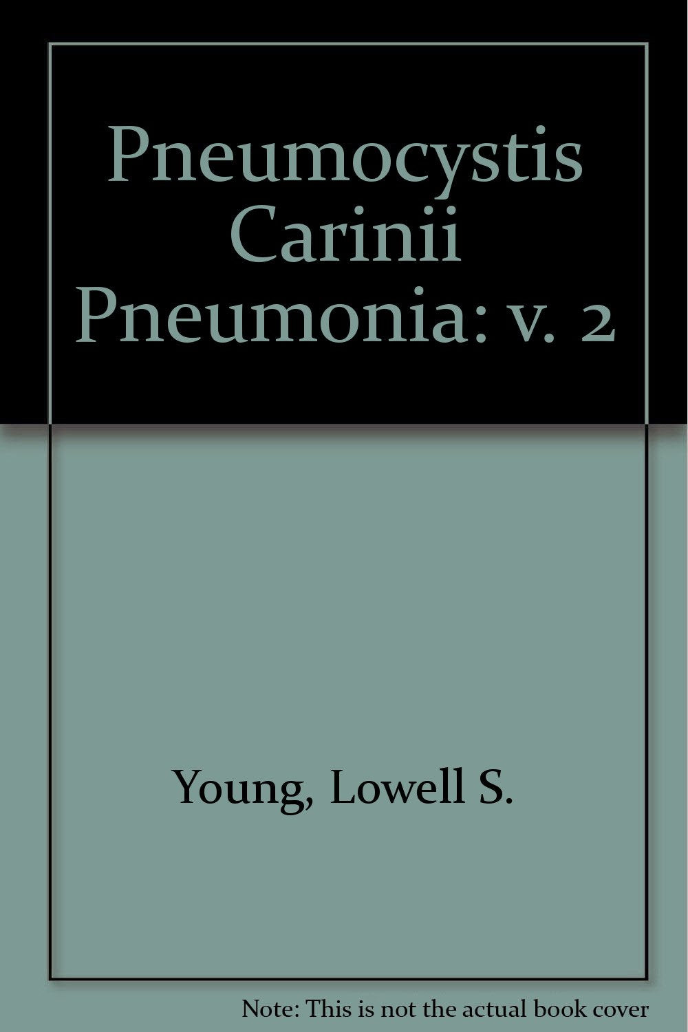 Pneumocystis Carinii Medicine