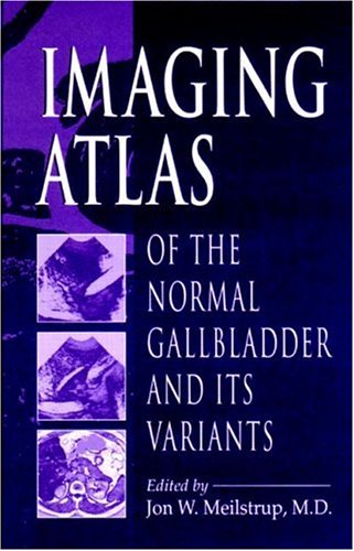 Imaging Atlas of the Normal Gallbladder and Its Variants Medicine