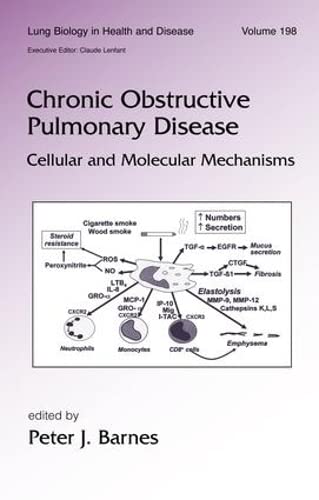 Chronic Obstructive Pulmonary Disease: Cellular and Molecular Mechanisms (Lung Biology in Health and Disease) Music