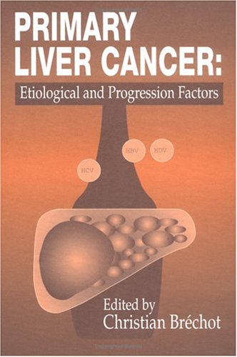 Primary Liver Cancer: Etiological and Progression Factors Medicine