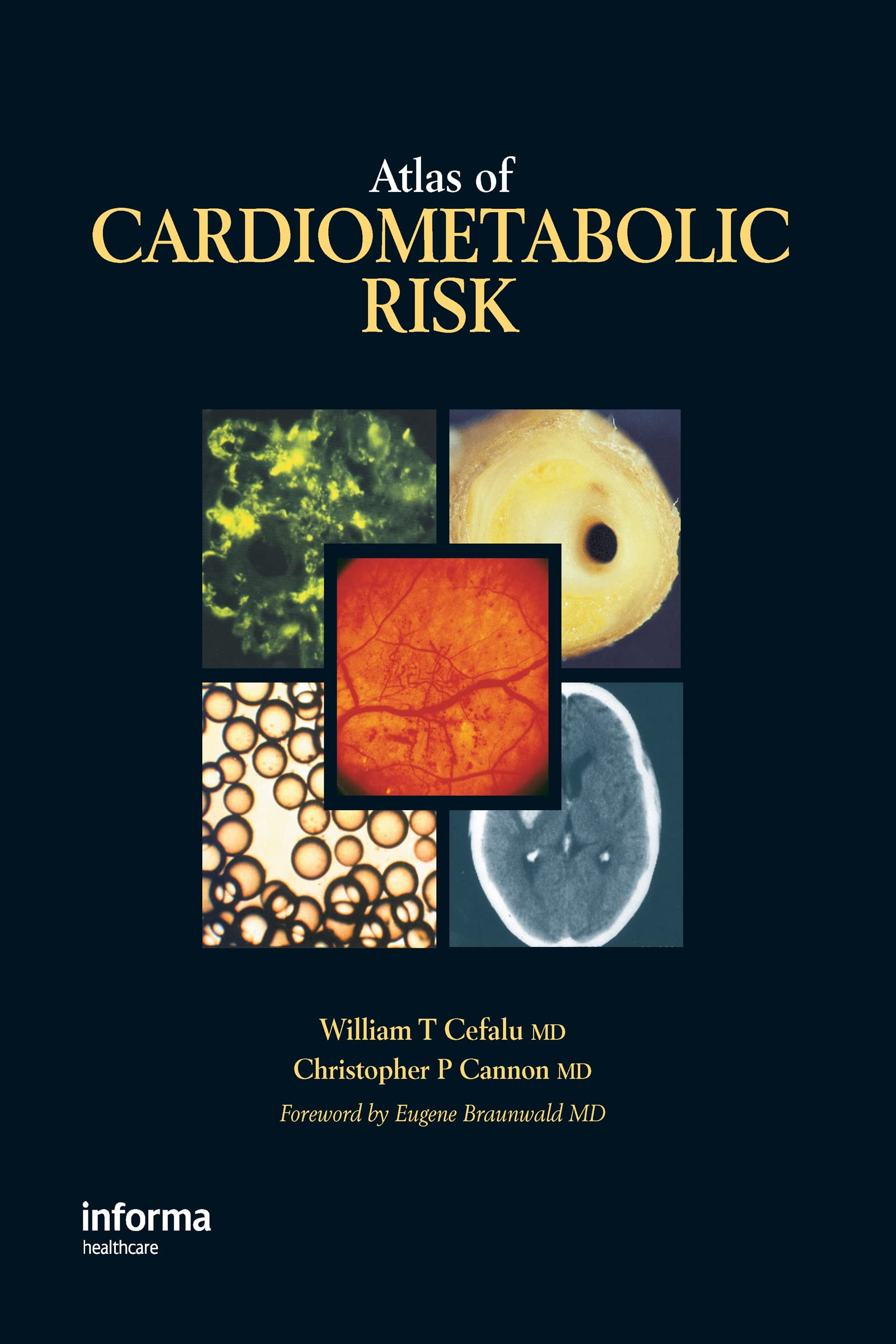 Atlas of Cardiometabolic Risks Medicine