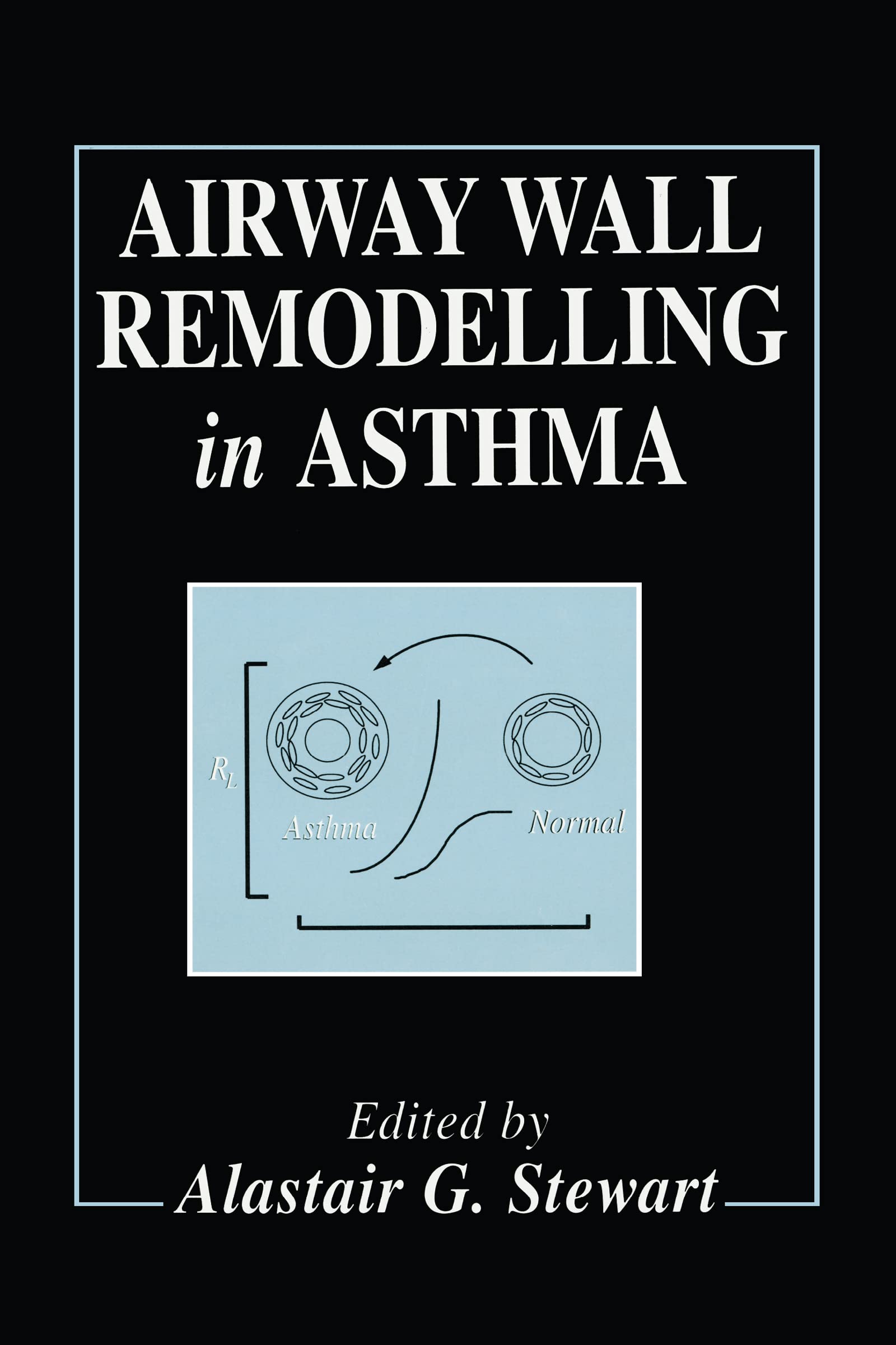 Airway Wall Remodelling in Asthma Medicine