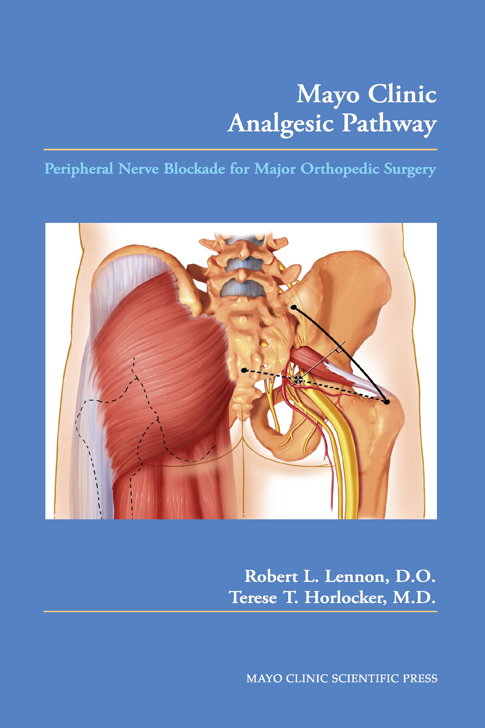 Mayo Clinic Analgesic Pathway Medicine