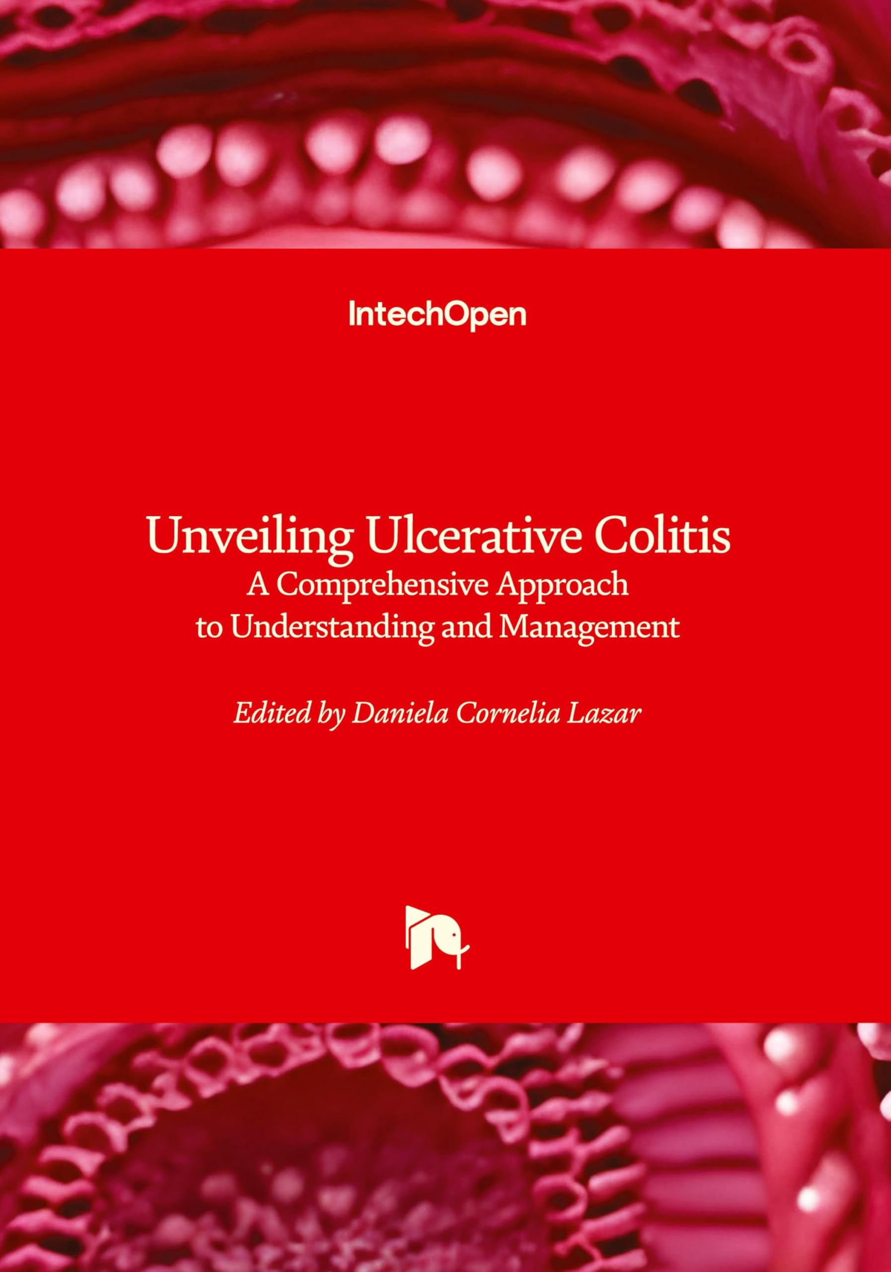 Unveiling Ulcerative Colitis - A Comprehensive Approach to Understanding and Management: A Comprehensive Approach to Understanding and Management Medicine