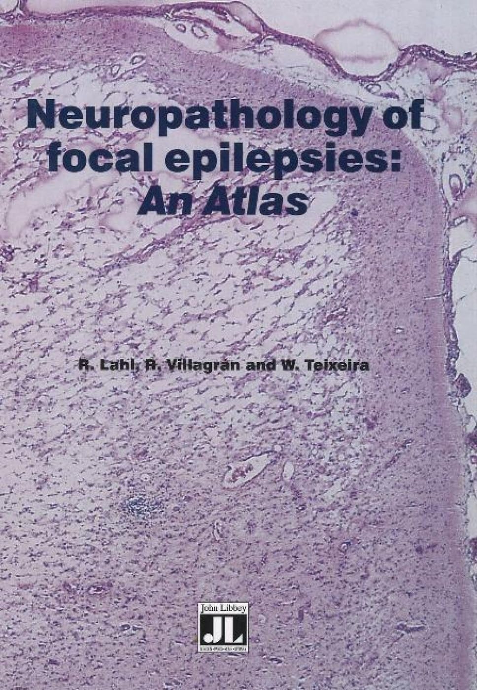 Neuropathology of Focal Epilepsies: An Atlas Medicine
