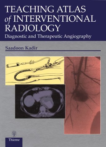 Teaching Atlas of Interventional Radiology: Diagnostic and Therapeutic Angiography Books