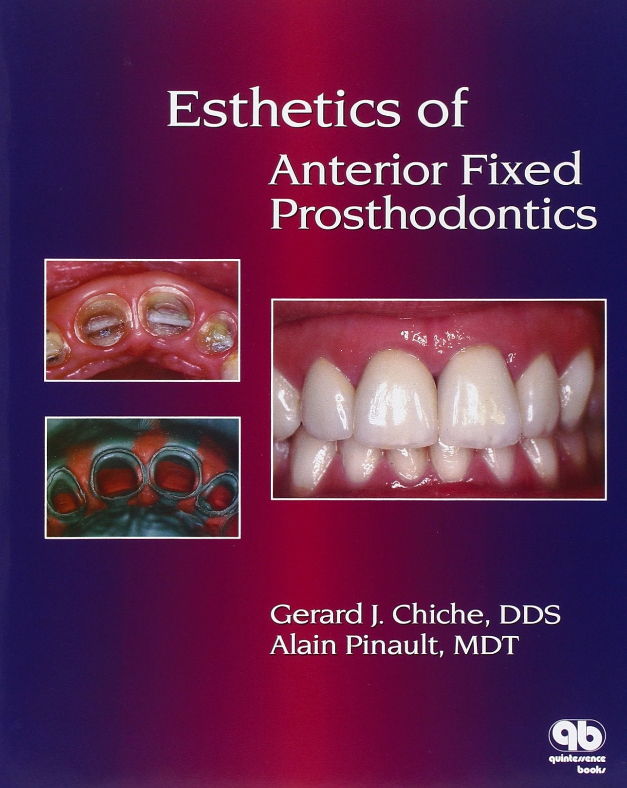 Esthetics of Anterior Fixed Prosthodontics book