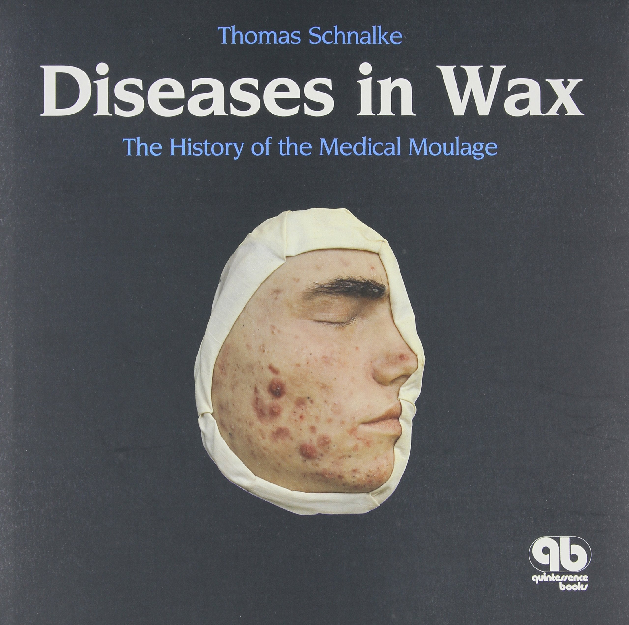 Diseases in Wax: The History of the Medical Moulage Medicine