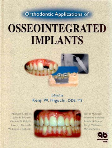 Orthodontic Applications of Osseointegrated Implants Medicine