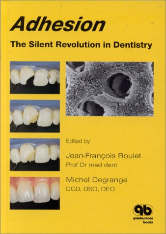 Adhesion: The Silent Revolution In Dentistry Medicine