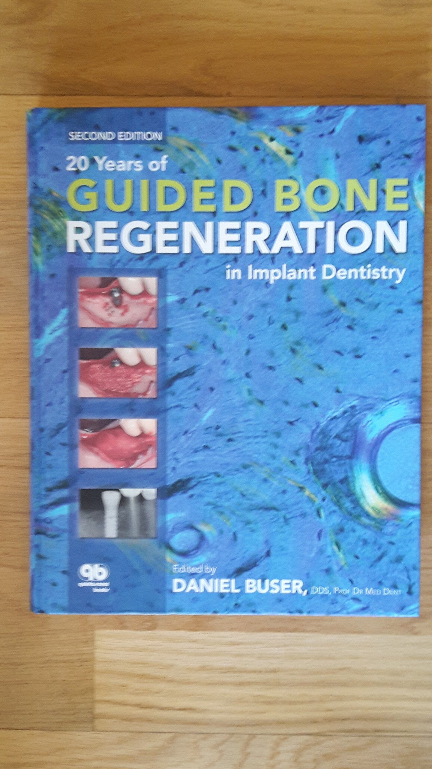 20 Years of Guided Bone Regeneration in Implant Dentistry Medicine
