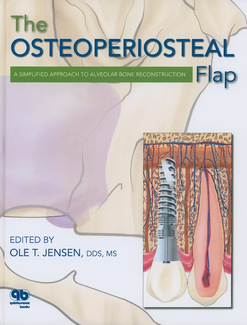 The Osteoperiosteal Flap: A Simplified Approach to Alveolar Bone Reconstruction Medicine