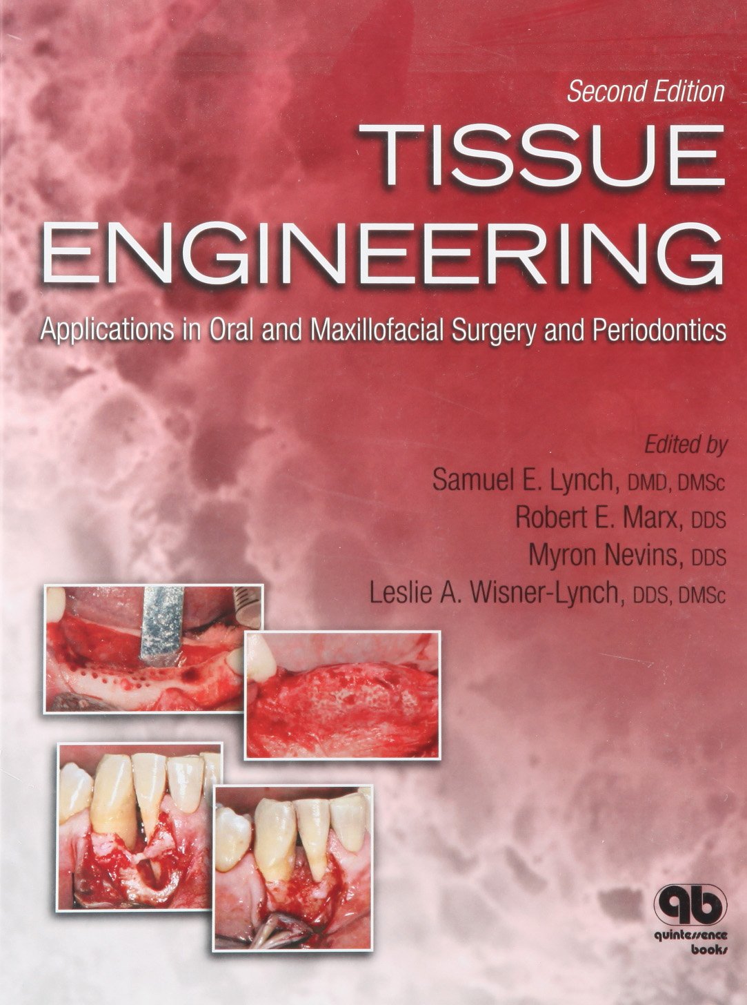 Tissue Engineering: Applications in Oral and Maxillofacial Surgery and Periodontics book
