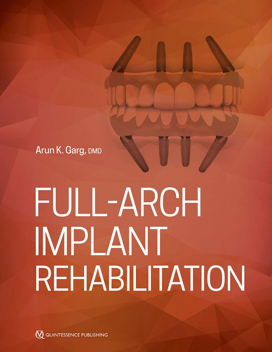 Full-Arch Implant Rehabilitation Medicine